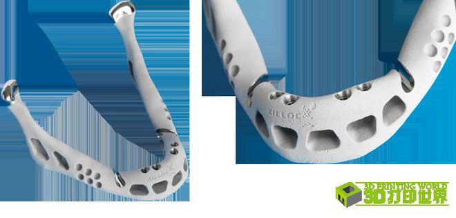 Xilloc收购荷兰OTN公司,扩展完善3D打印骨科产品线